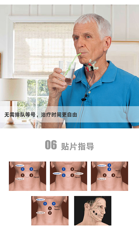 居家康复vitalstim吞咽障碍理疗仪|上海vitalstim理疗仪器租赁价格